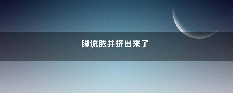 脚流脓并挤出来了